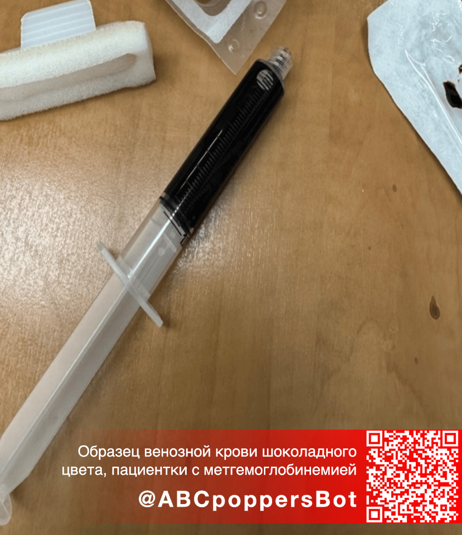 Если принять попперс внутрь в Тольятти это вызывает метгемоглобинемию. Смертельное состояние Если принять попперс внутрь в Тольятти это вызывает метгемоглобинемию. Смертельное состояние